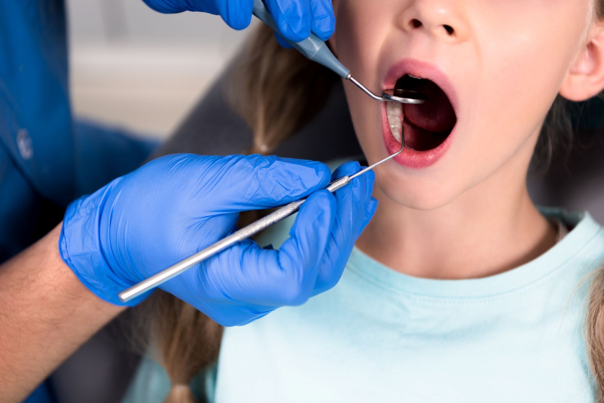 kid at dentist with mouth open