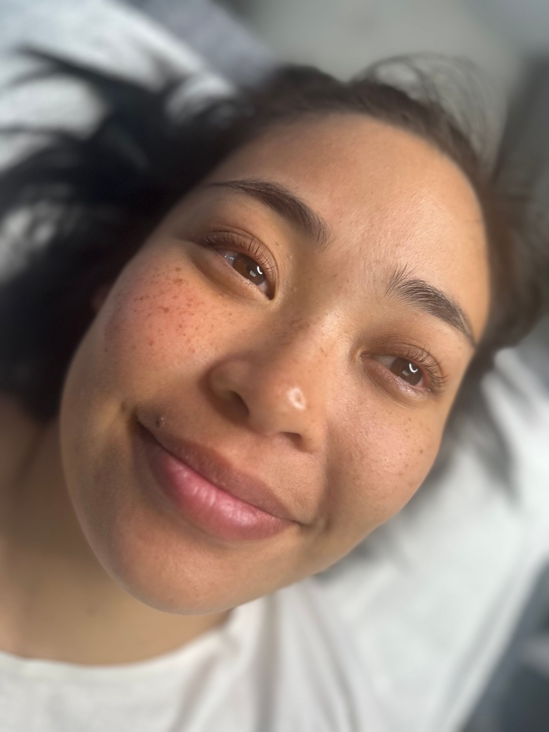 Smiling person with small freckles, recently tattooed eyeliner, in a medical or beauty setting.