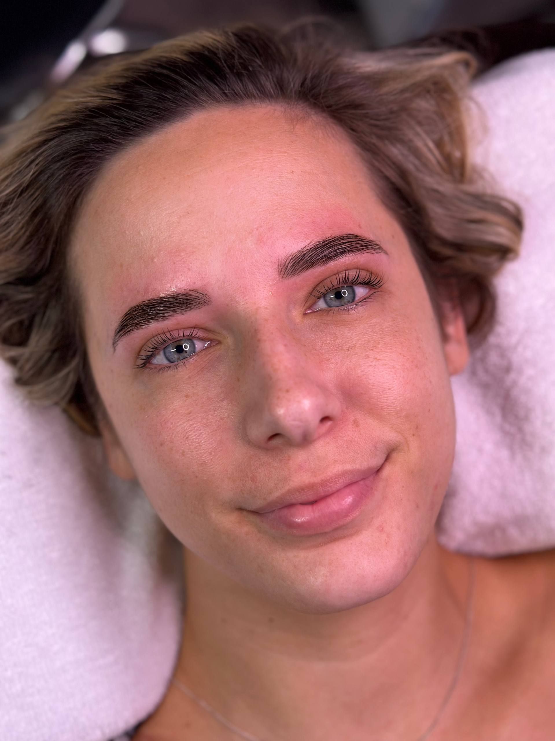 Woman with freshly tattooed eyebrows, lying down. Redness around brows, smiling at camera.