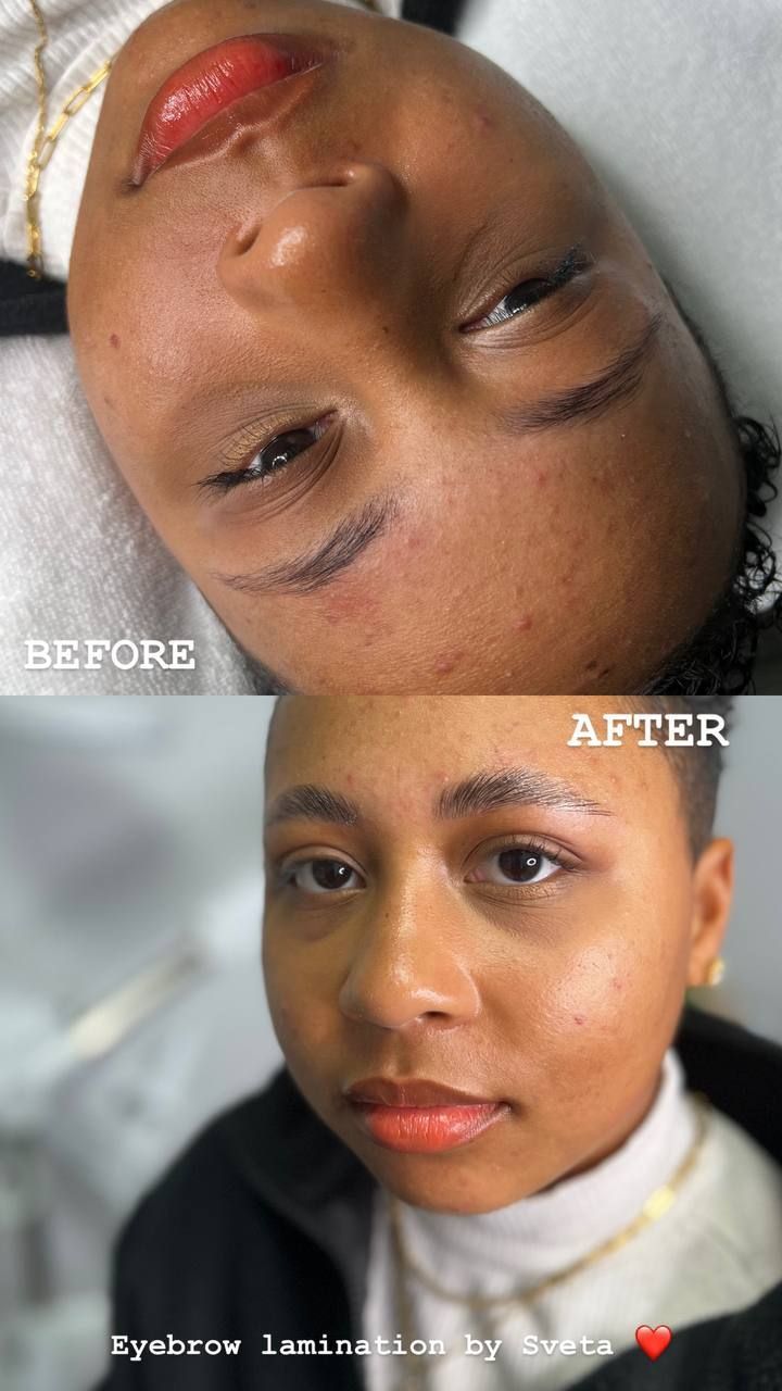 Comparison of brows before and after microblading. Top: browless. Bottom: filled brows.