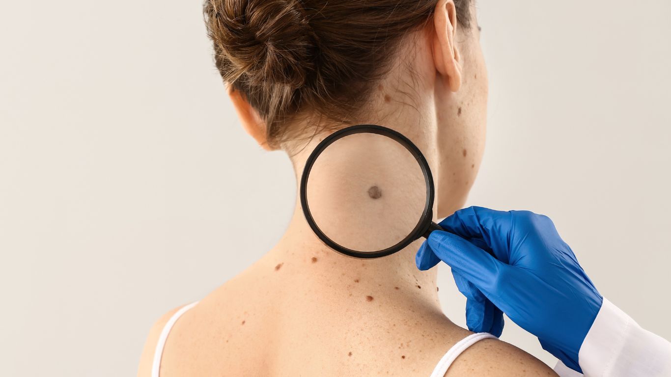 Doctor Examining a Mole on a Woman's Neck With a Magnifying Glass — Tewantin Medical Centre In Tewantin, QLD