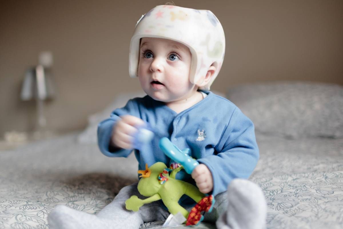 A baby wearing a cranial remolding helmet from Kenney Orthopedic near Lexington, Kentucky (KY)
