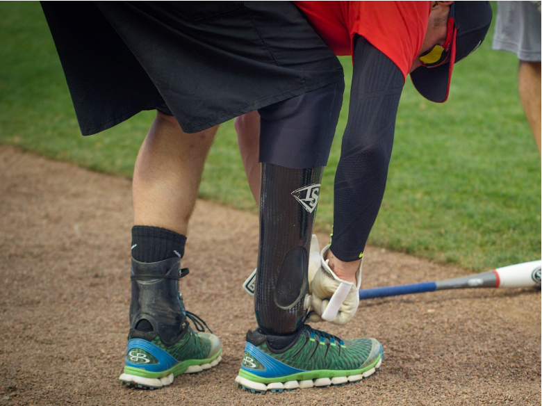 Prosthetics & Artificial Limbs | Kenney Orthopedics