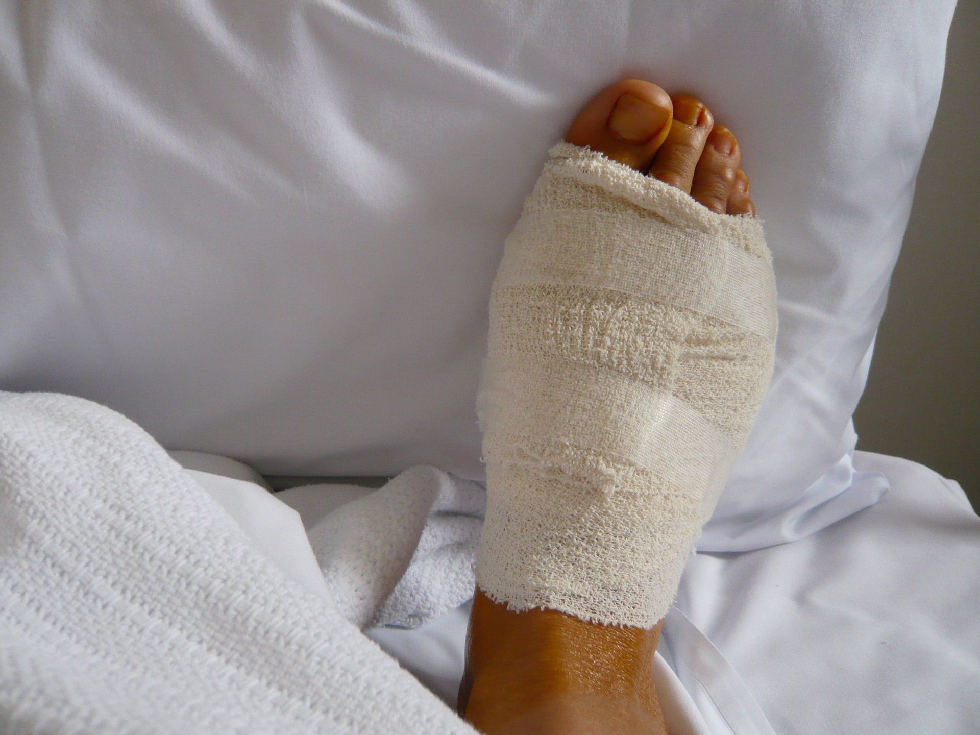 Foot with a bandage wrapped around it, resting on a white sheet.