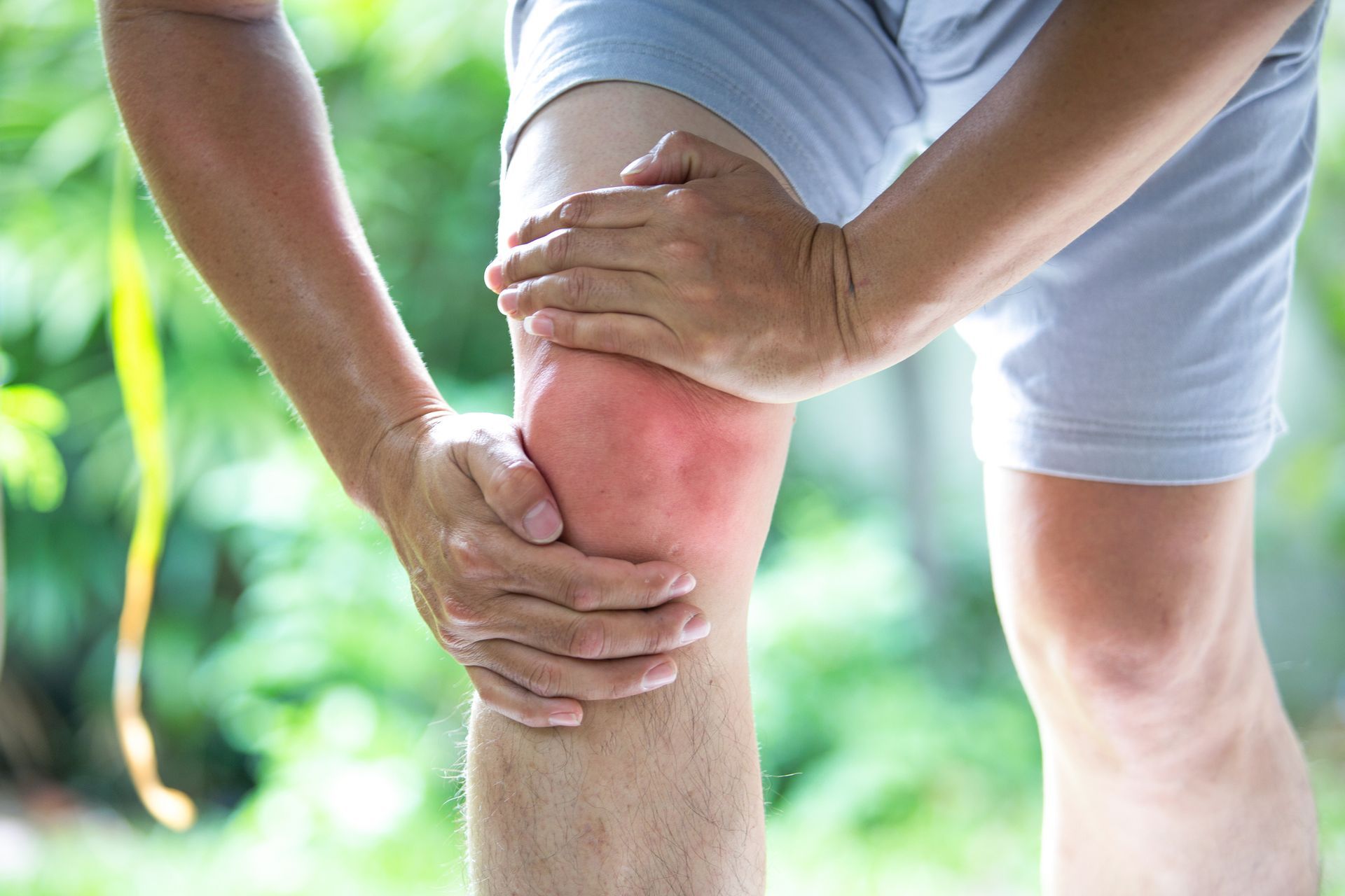 Man holding his knee, which is red and inflamed, likely due to pain. Outdoors, wearing shorts.