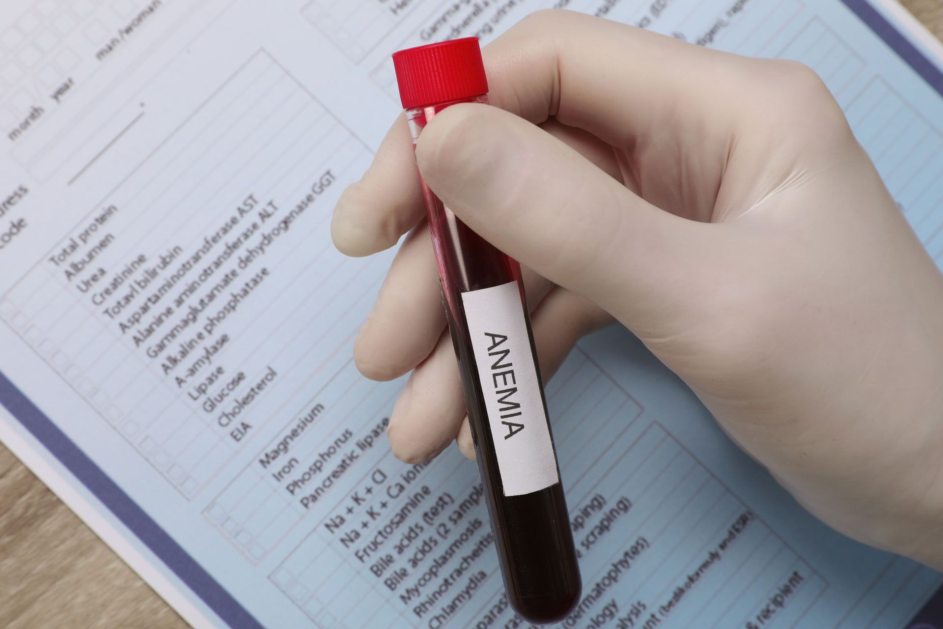 Hand holding a blood sample vial labeled 