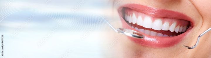 a close up of a woman 's mouth wearing a headset . | Rosecrans Dental Group - Bellflower, California