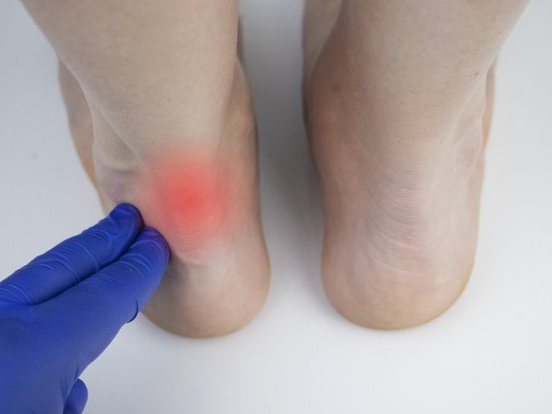 achilles tendon disorders treatments in new albany