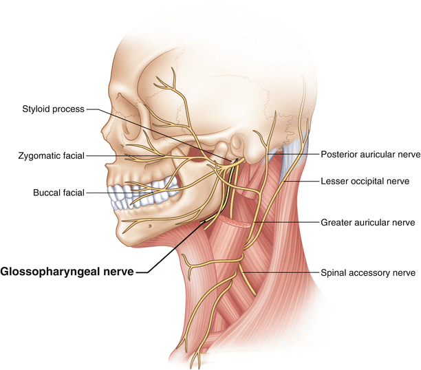 Glossopharyngeal Neuralgia