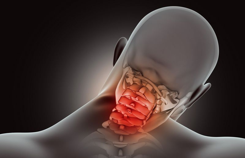 Neck Pain