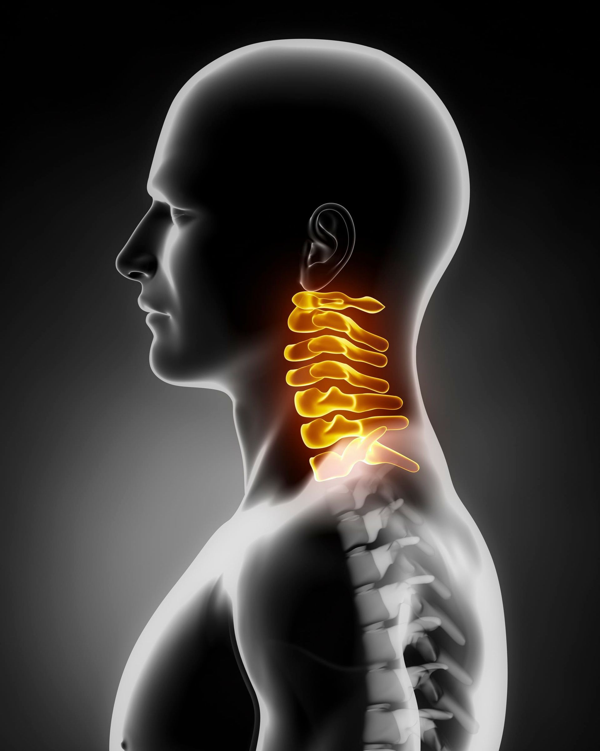 Cervical Spine Conditions