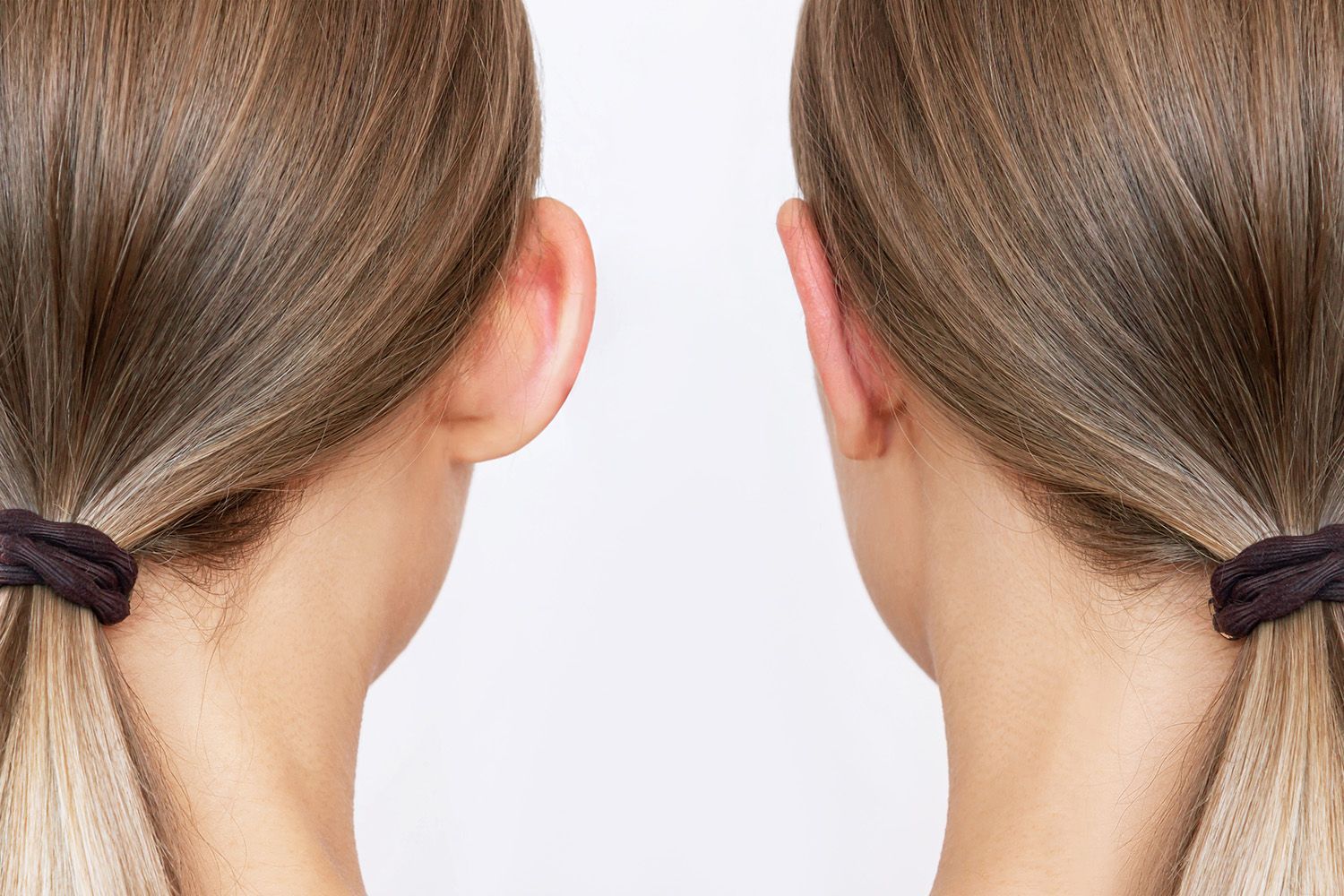 before and after earlobe repair