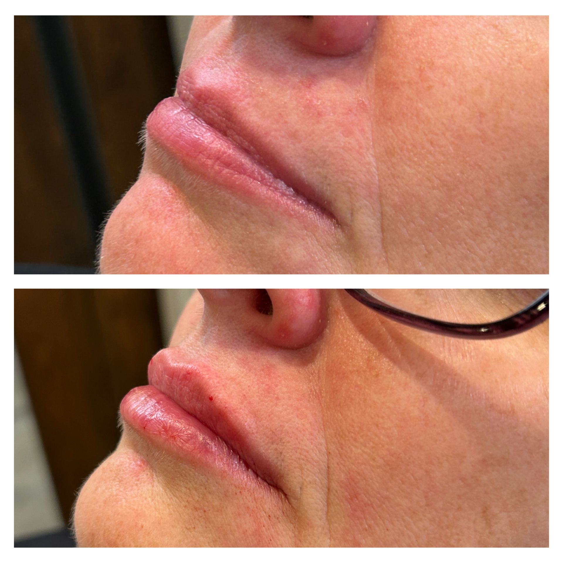 A before and after photo of a woman 's lips with glasses.