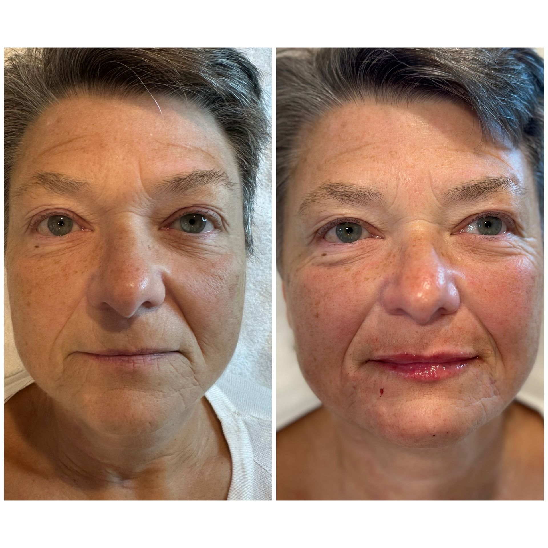 A before and after photo of a woman 's face.