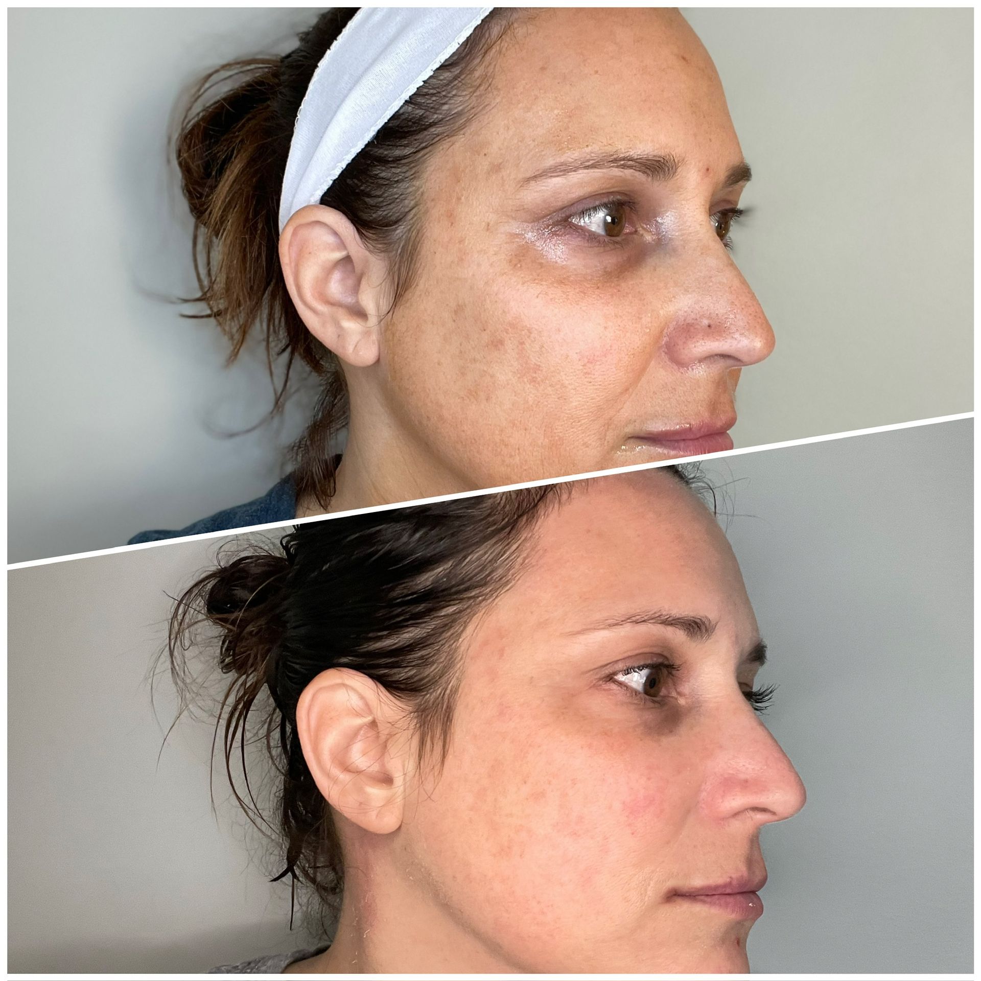 A before and after photo of a woman 's face.