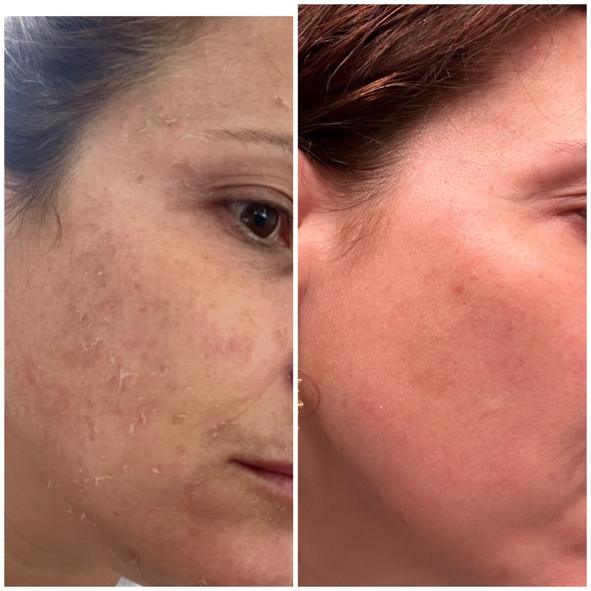 A before and after photo of a woman 's face.