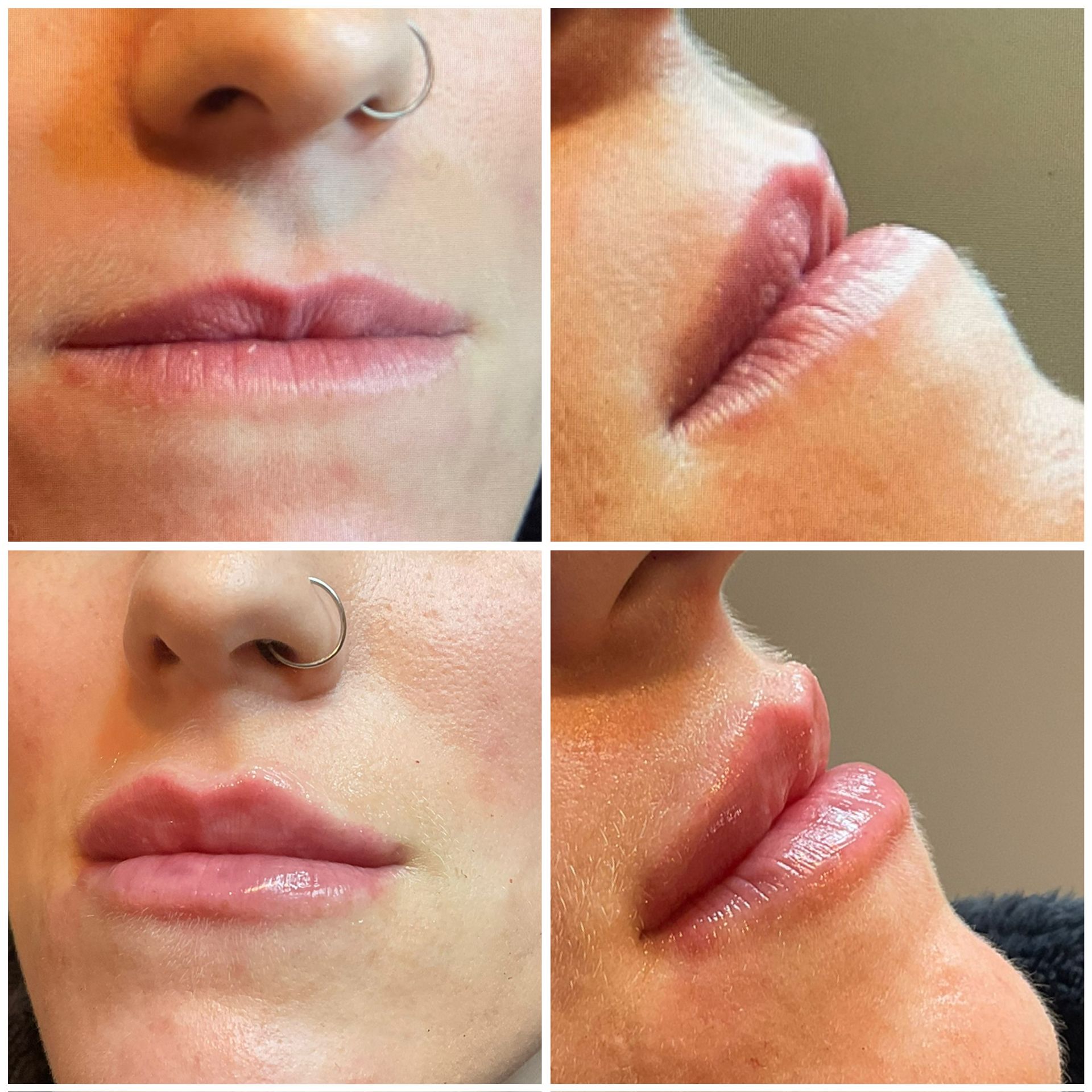 A collage of four photos of a woman 's lips with a nose ring.