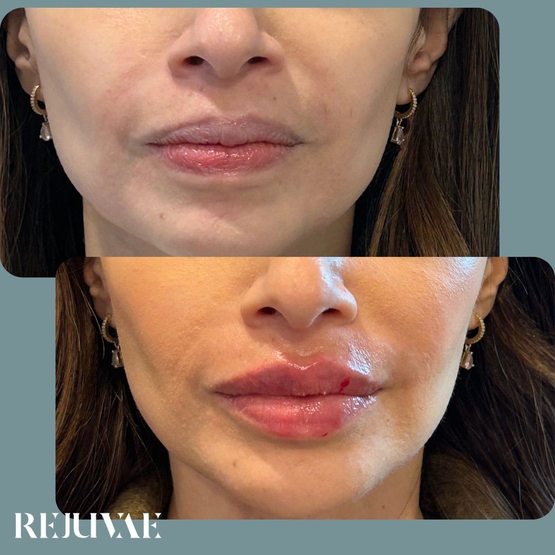 A before and after photo of a woman 's face