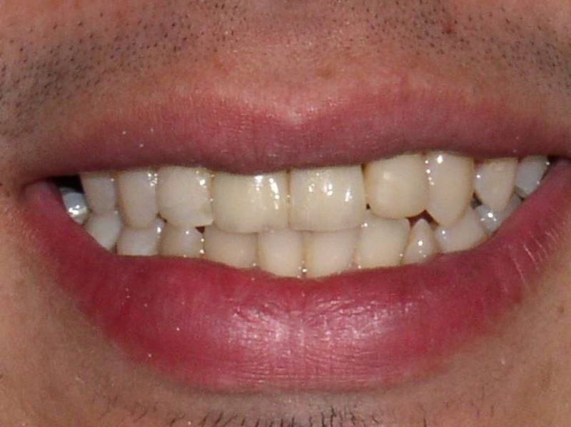 Balboa Dental Clinic - Odontología