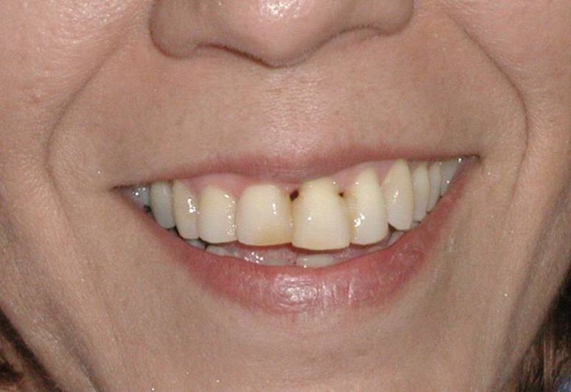 Balboa Dental Clinic - odontología cosmetica