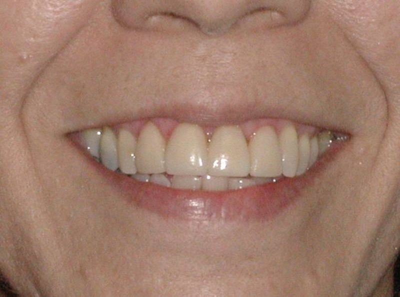 Balboa Dental Clinic -  limpieza dental