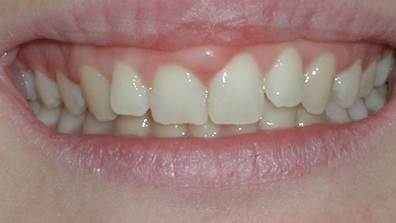 Balboa Dental Clinic - Consulta de encías