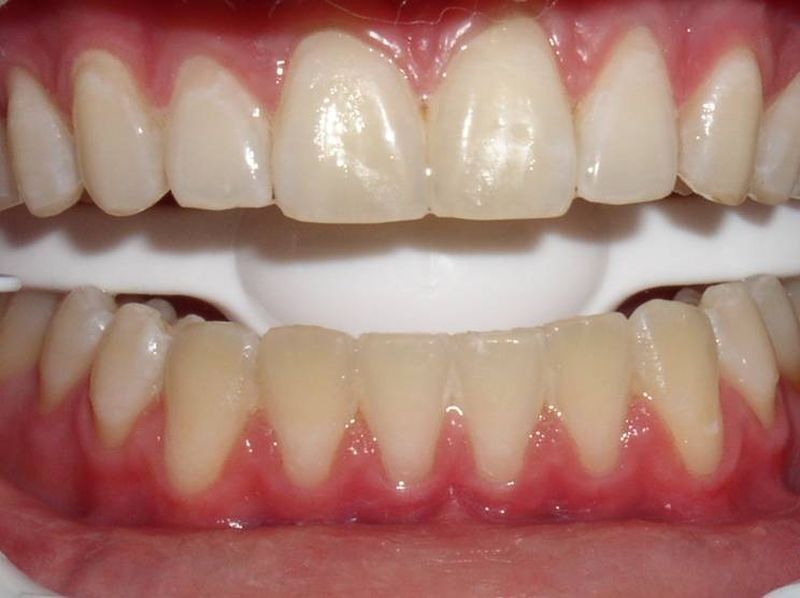 Balboa Dental Clinic - Tratamiento Dental Efectivo