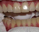 Balboa Dental Clinic - Examen Dental