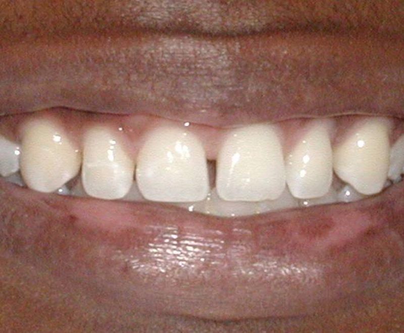 Balboa Dental Clinic - Examen dental