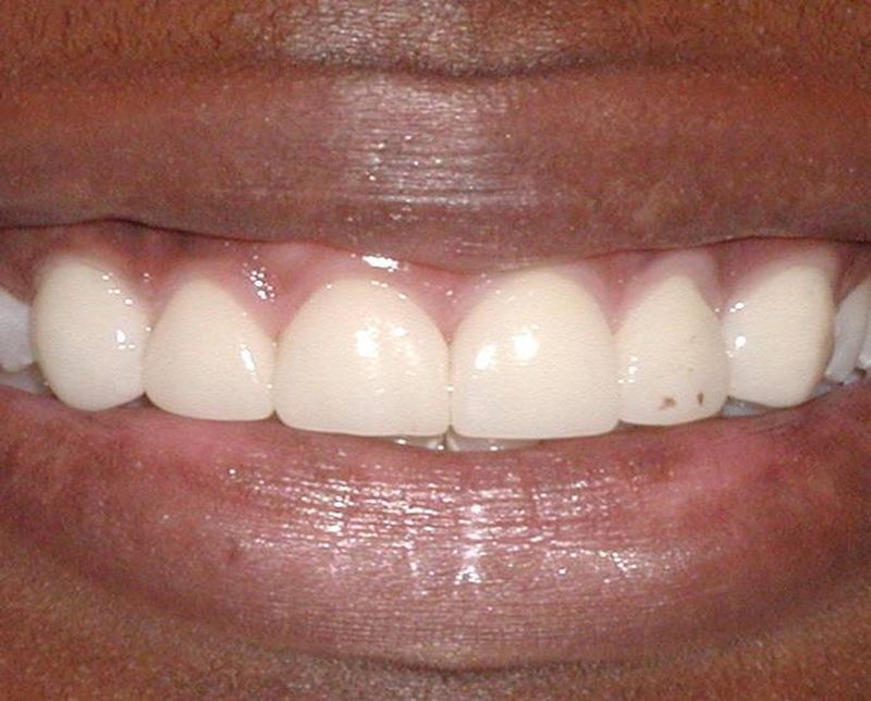 Balboa Dental Clinic - Examen dental efectivo