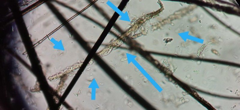 Ingrandimento al microscopio