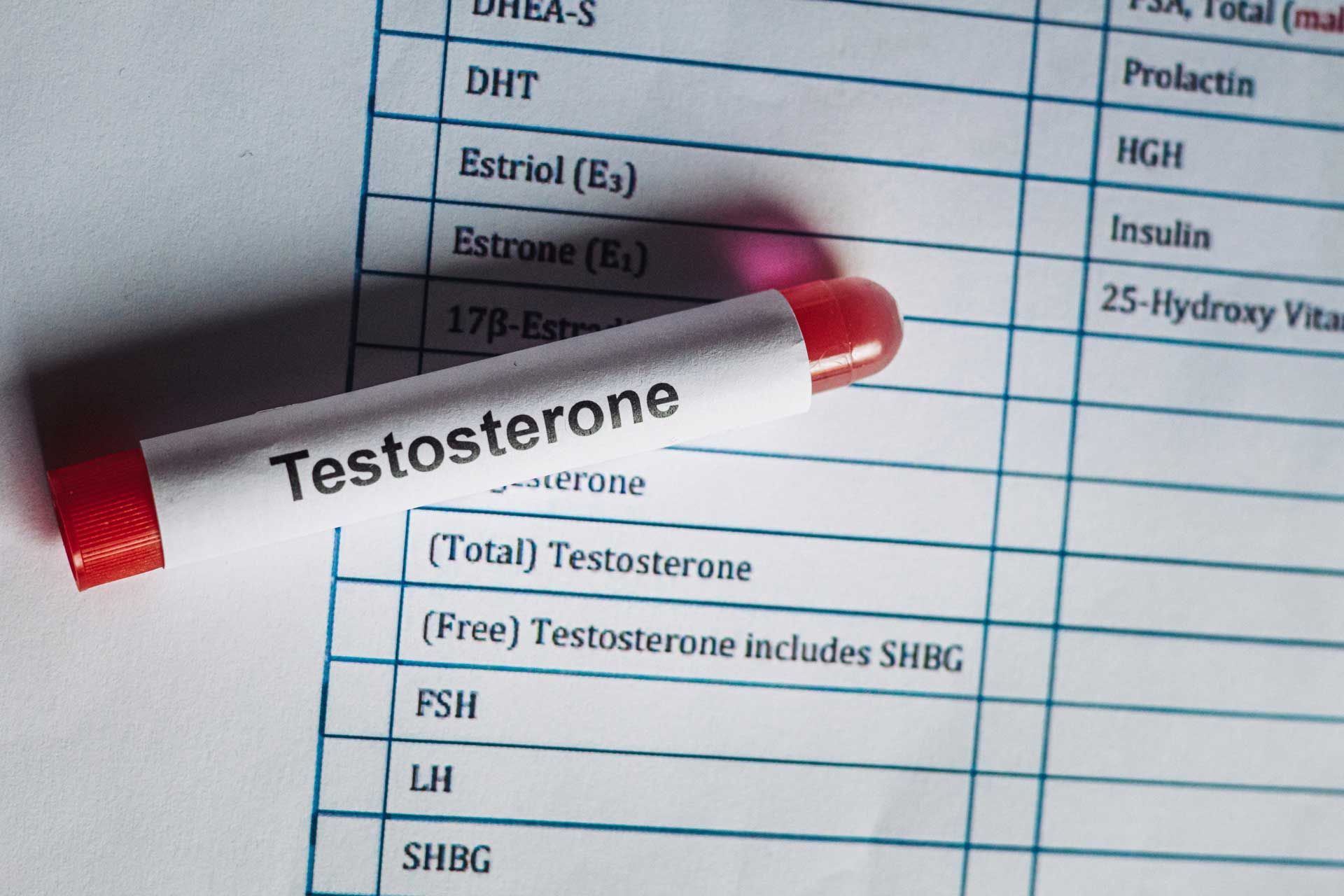 A tube labeled 'Testosterone' rests on a hormone test list. A tube labeled 'Testosterone' rests on a hormone test list.