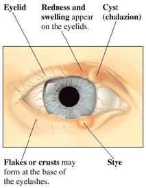 eye care exams The Villages & Ocala, FL