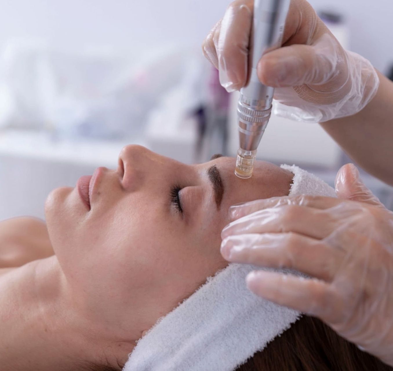 microneedling à agadir dr ghizlaine hayou