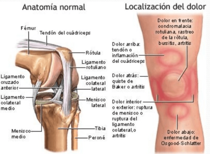 ¿cómo Saber Si Tengo Una Lesión En La Rodilla