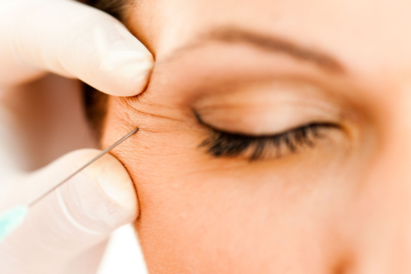 Person receiving an injection near their eye, likely for cosmetic purposes.