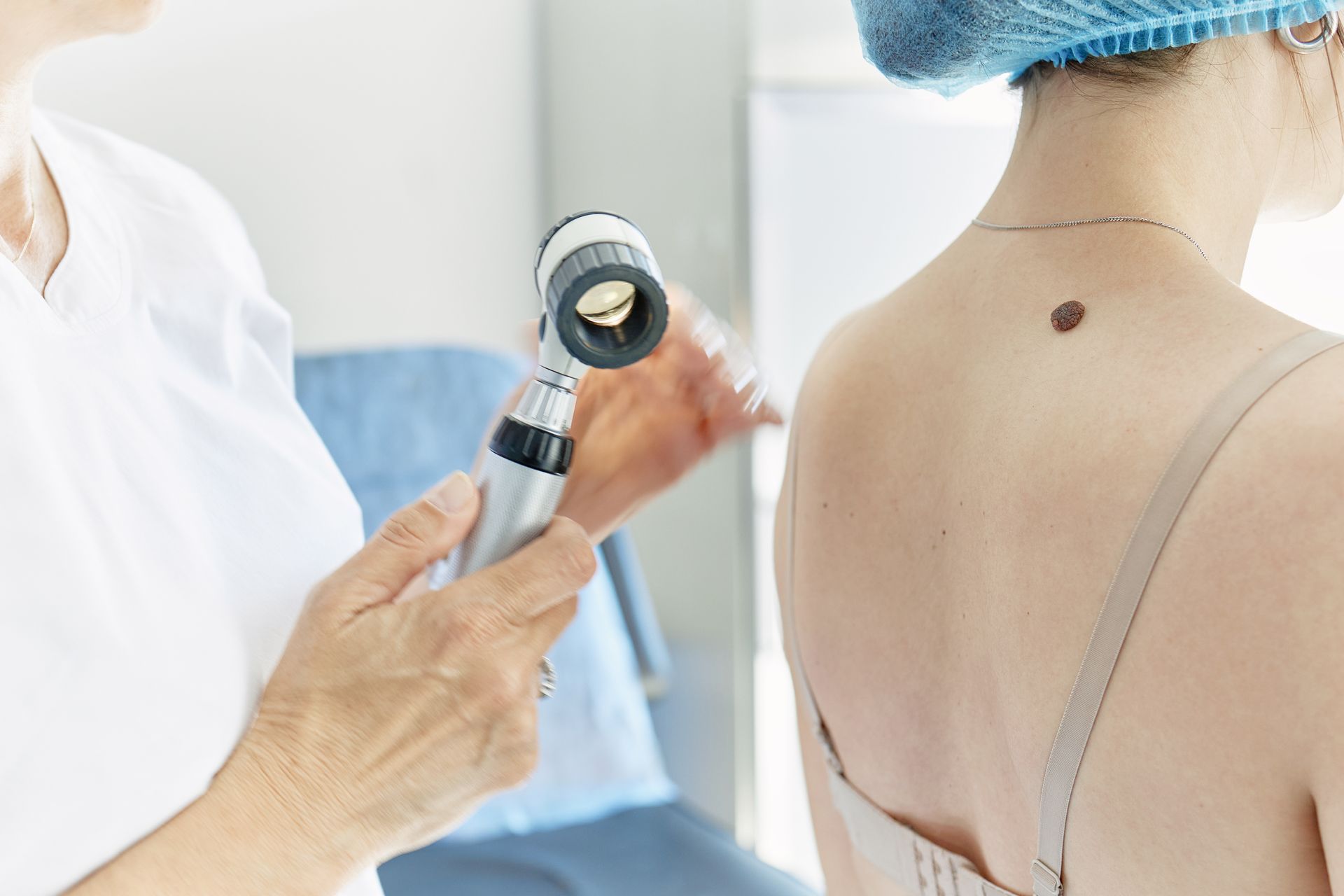 Un medico esamina un neo sulla schiena di un paziente con un dermatoscopio in un ambiente medico.
