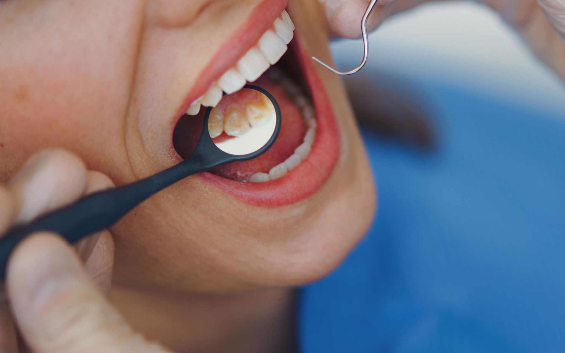 A woman is getting her teeth examined by a dentist