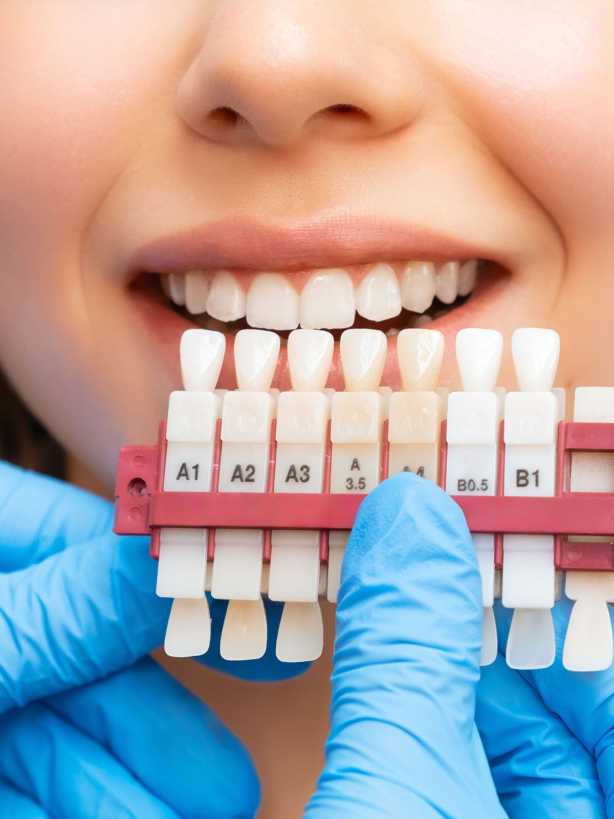 A woman is getting her teeth checked by a dentist