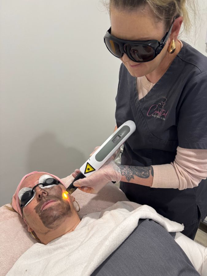 Person receiving a laser skin treatment; technician holding a laser wand, both wearing protective eyewear.