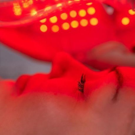 A woman is getting a laser treatment on her face.