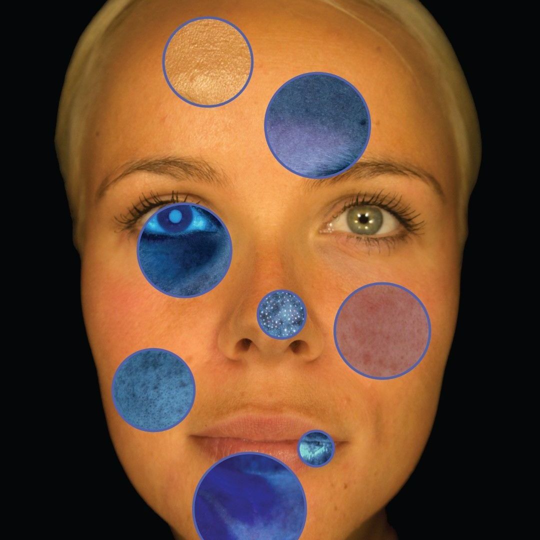 A close up of a woman 's face with blue circles on it