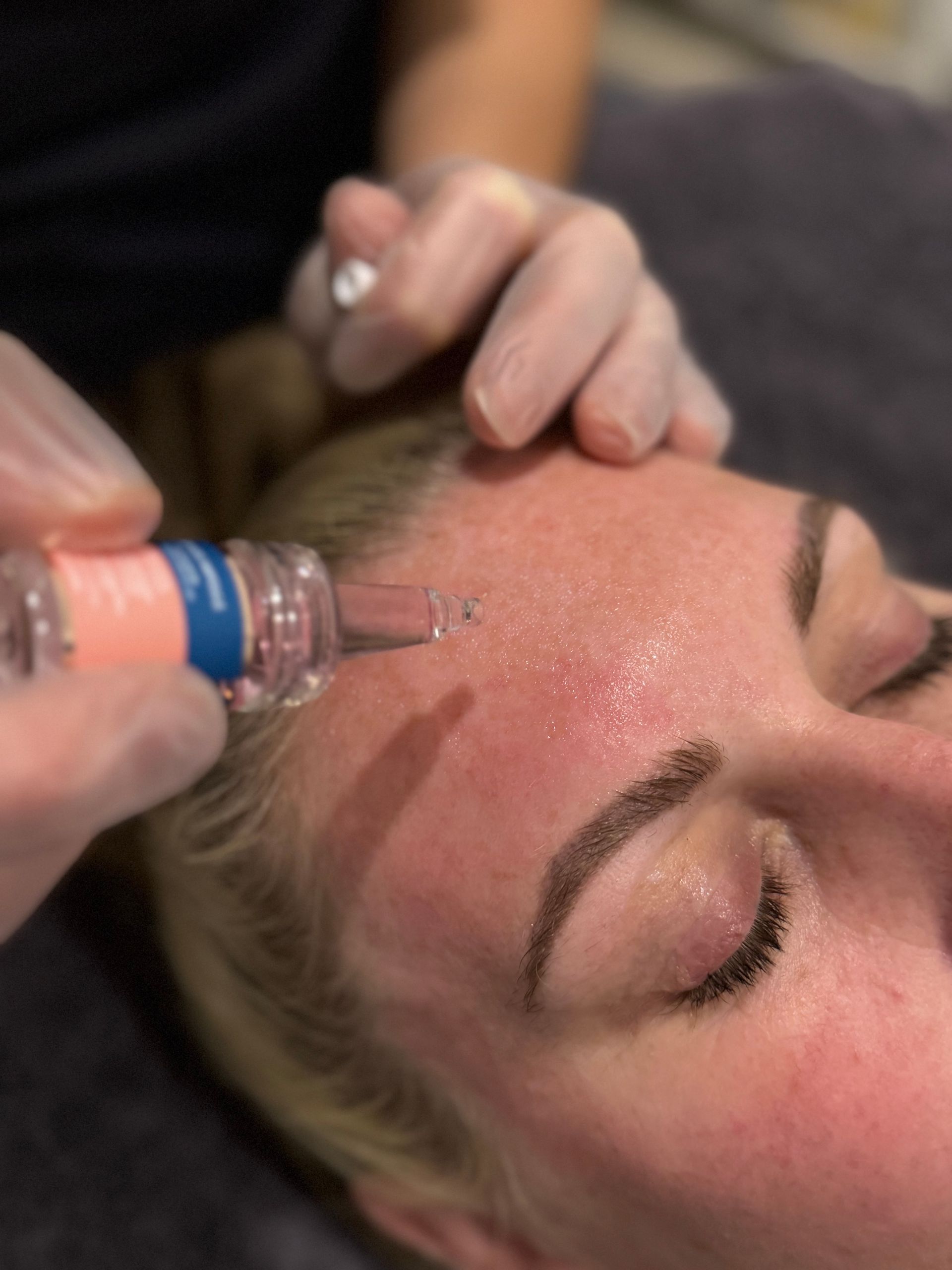 A close up of a woman 's face with blue circles on it