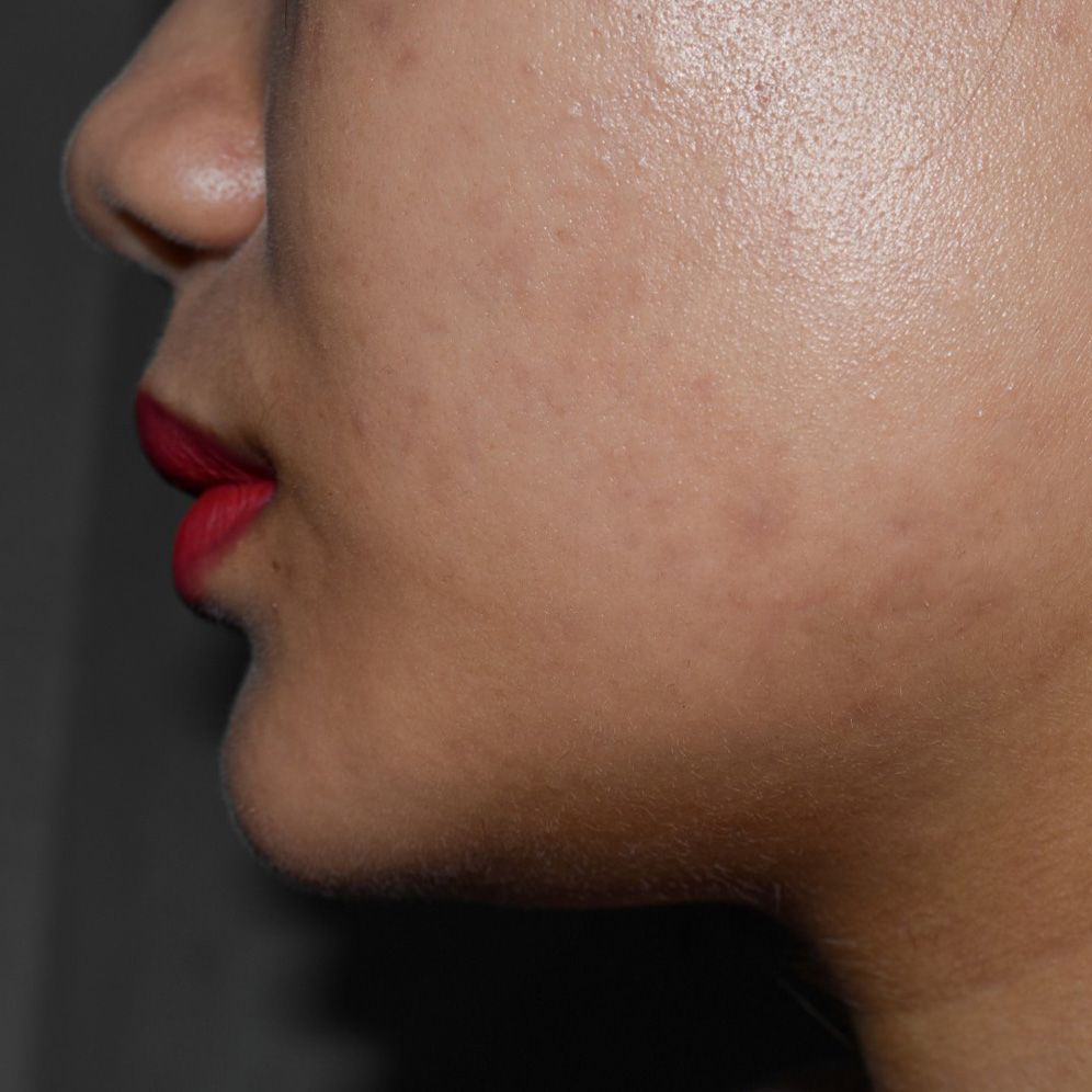 A close up of a woman 's face and neck with red lipstick.