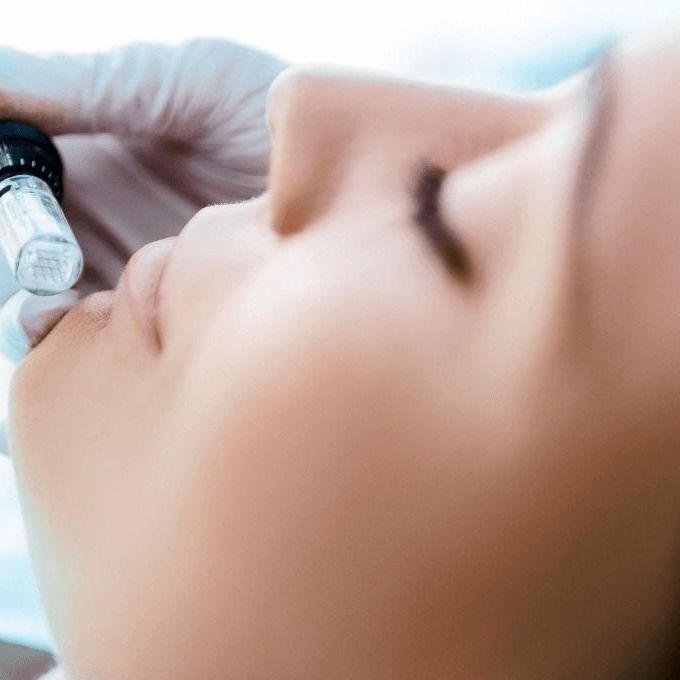 A woman is getting a laser treatment on her face.