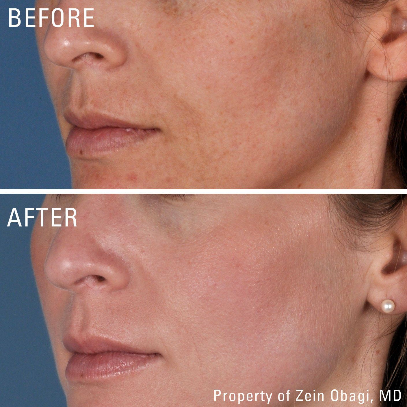 A before and after photo of a woman 's face