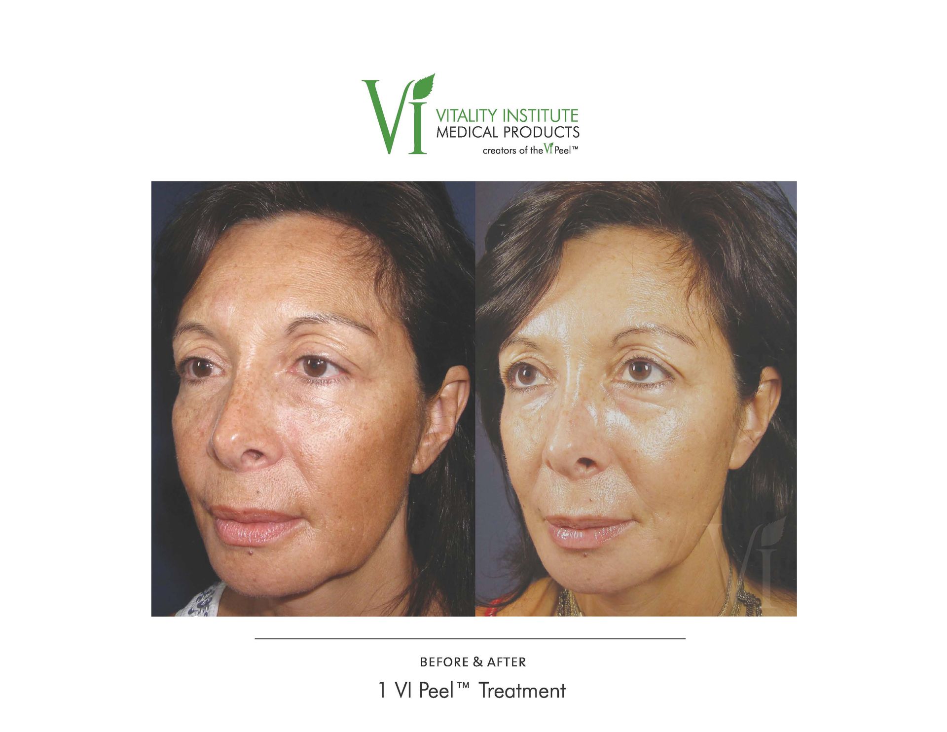 A before and after photo of a woman 's face