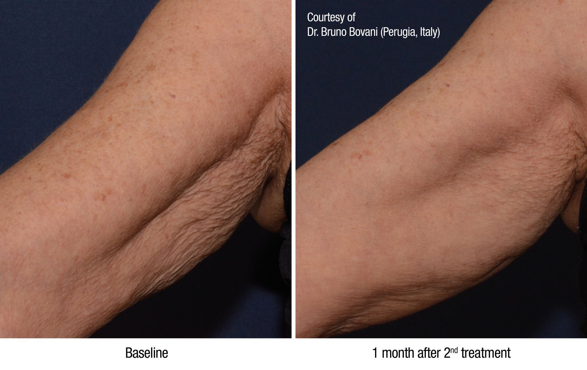 A before and after photo of a person 's arm