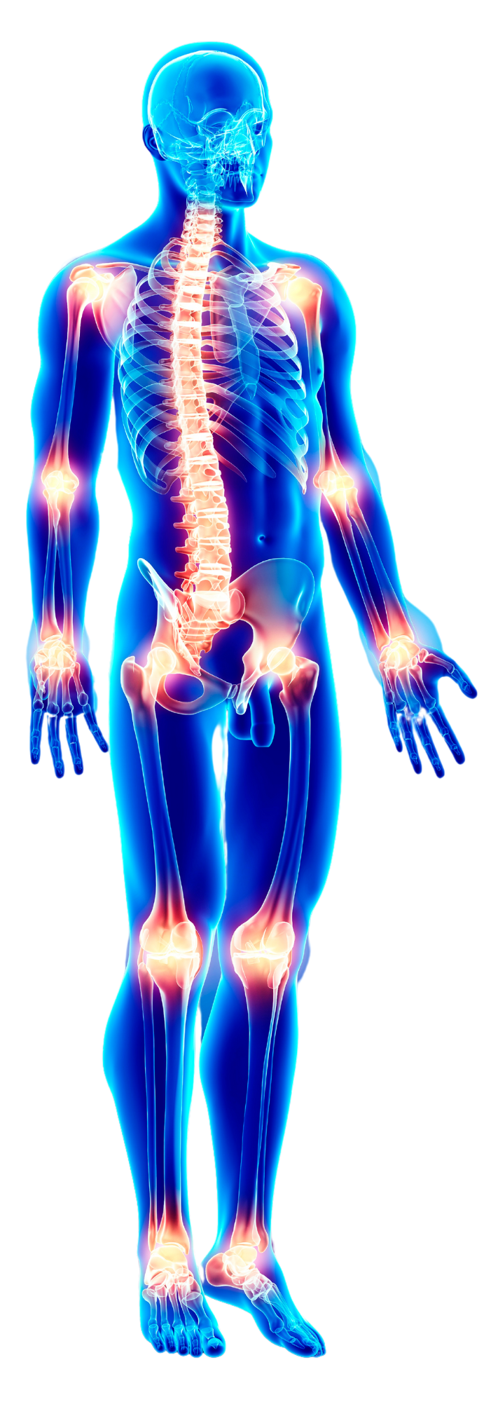 A 3d rendering of a man with arthritis in his joints and skeleton.