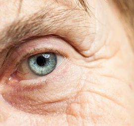 Senior Woman Eye - Glaucoma Treatment in Doylestown, PA